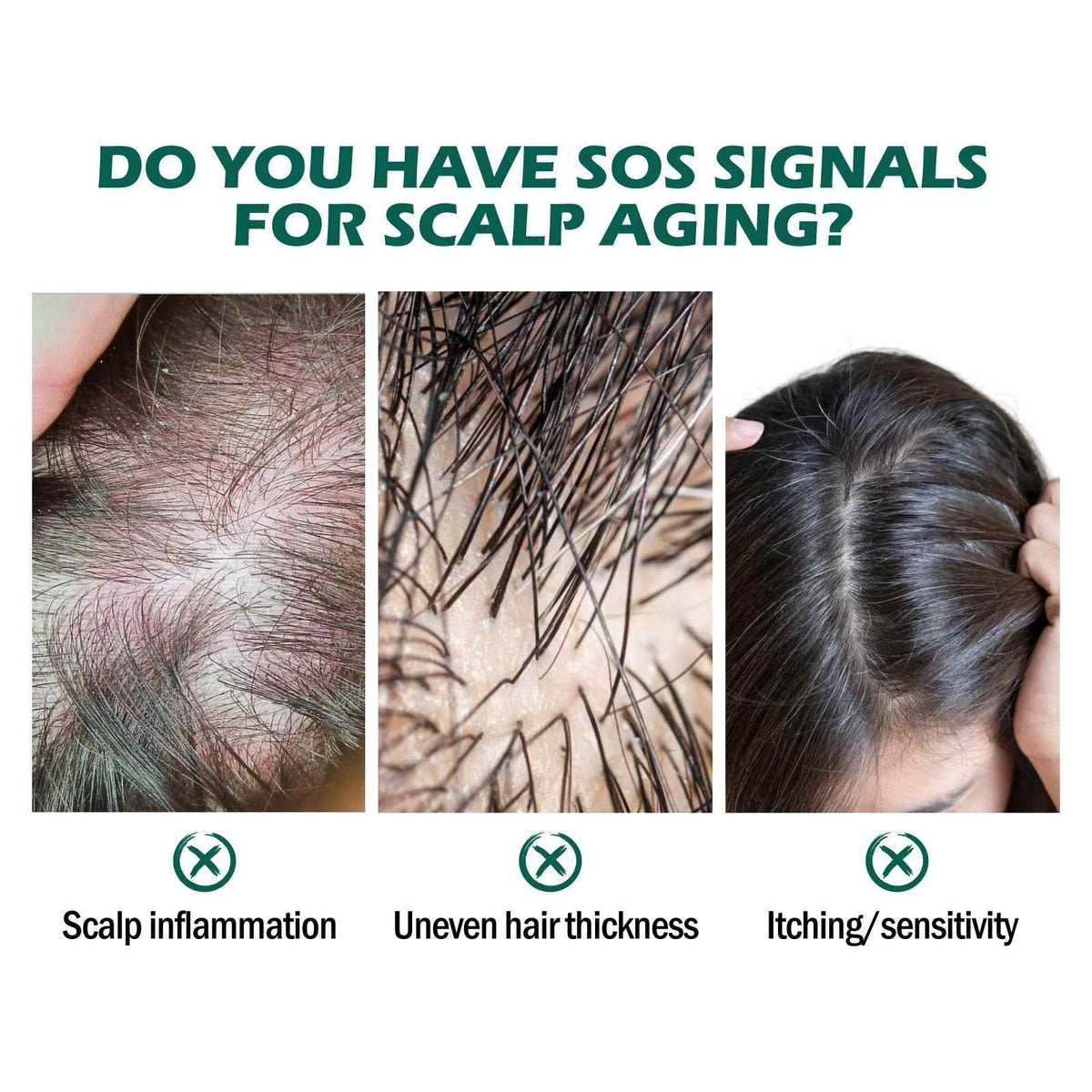 Scalp Recovery Oil — Deep Cleansing & Nourishing Blend