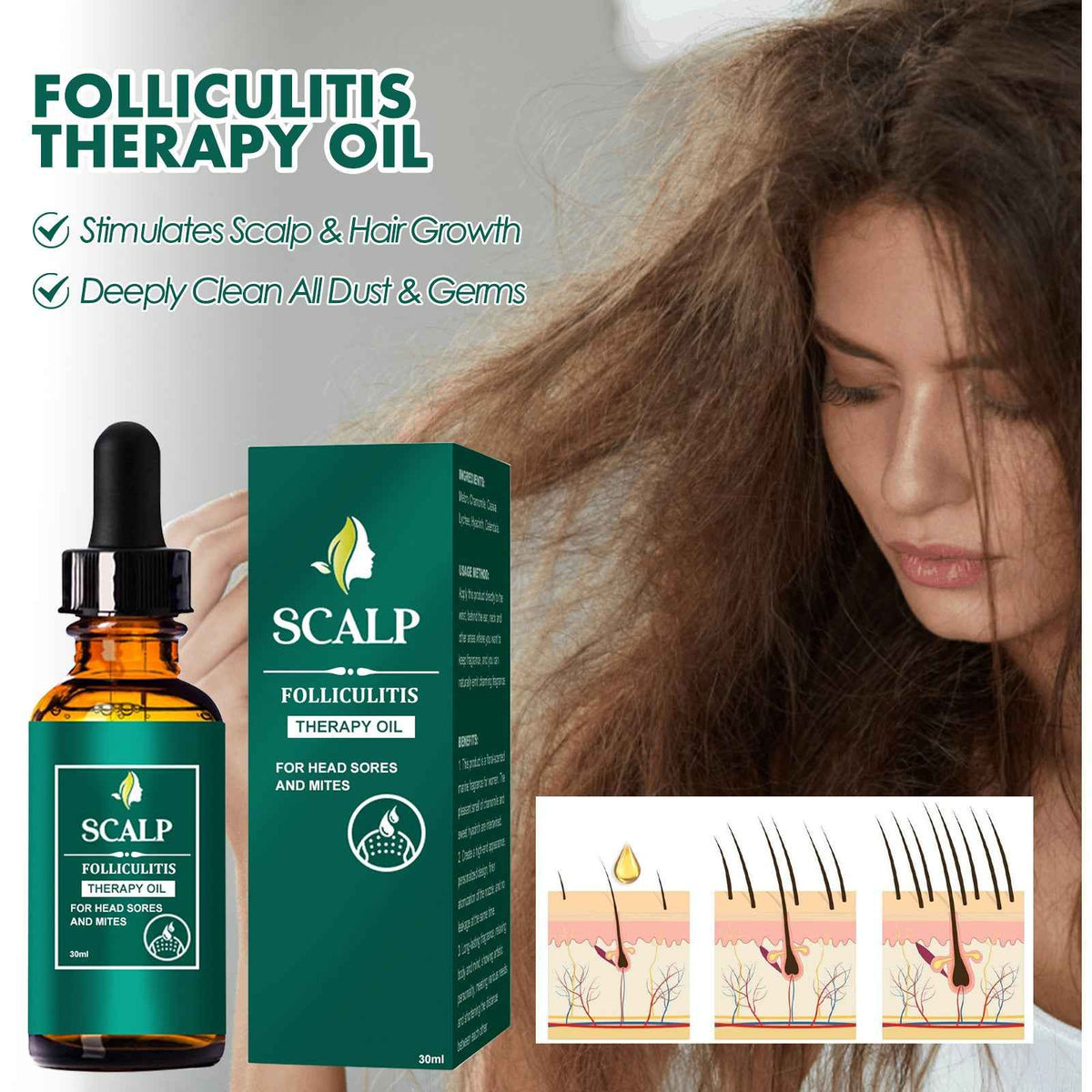 Scalp Recovery Oil — Deep Cleansing & Nourishing Blend