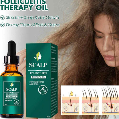 Scalp Recovery Oil — Deep Cleansing &amp; Nourishing Blend