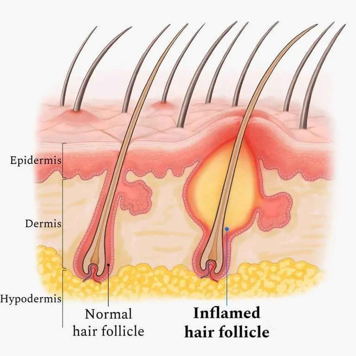 Scalp Recovery Oil — Deep Cleansing &amp; Nourishing Blend